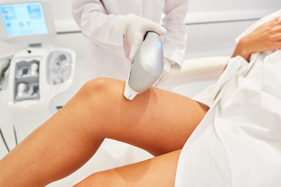 Ultraformer for Tightening the Skin on the Thigh